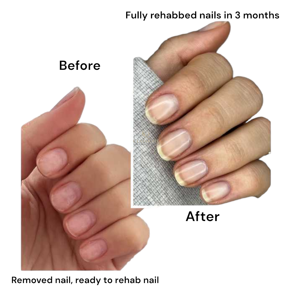 duri nail growth system