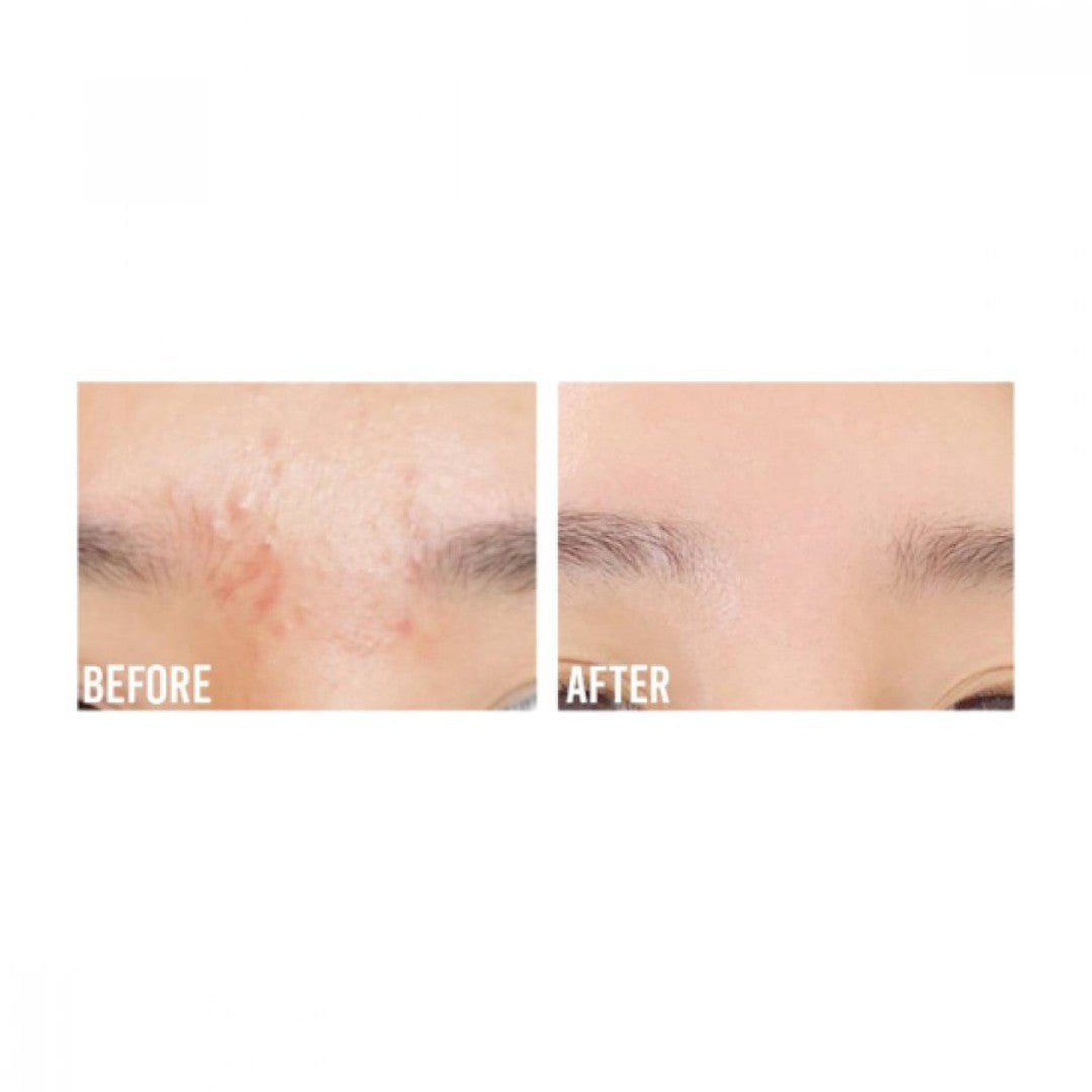 Beauty Of Joseon Glow Serum : Propolis + Niacinamide