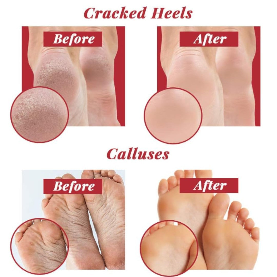 CHECI Dual Coarse & Medium Foot File #745682