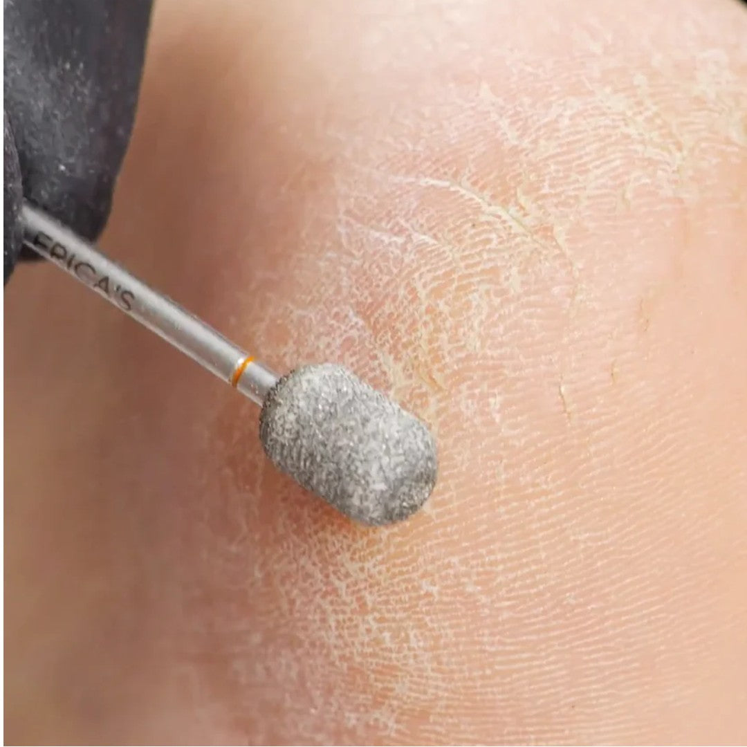 Erica's ATA Nail Drill Bits - Torch Pedicure 3/32