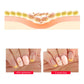 Jello Jello killing Gel Base Coat, burn gel​, burning gel​
