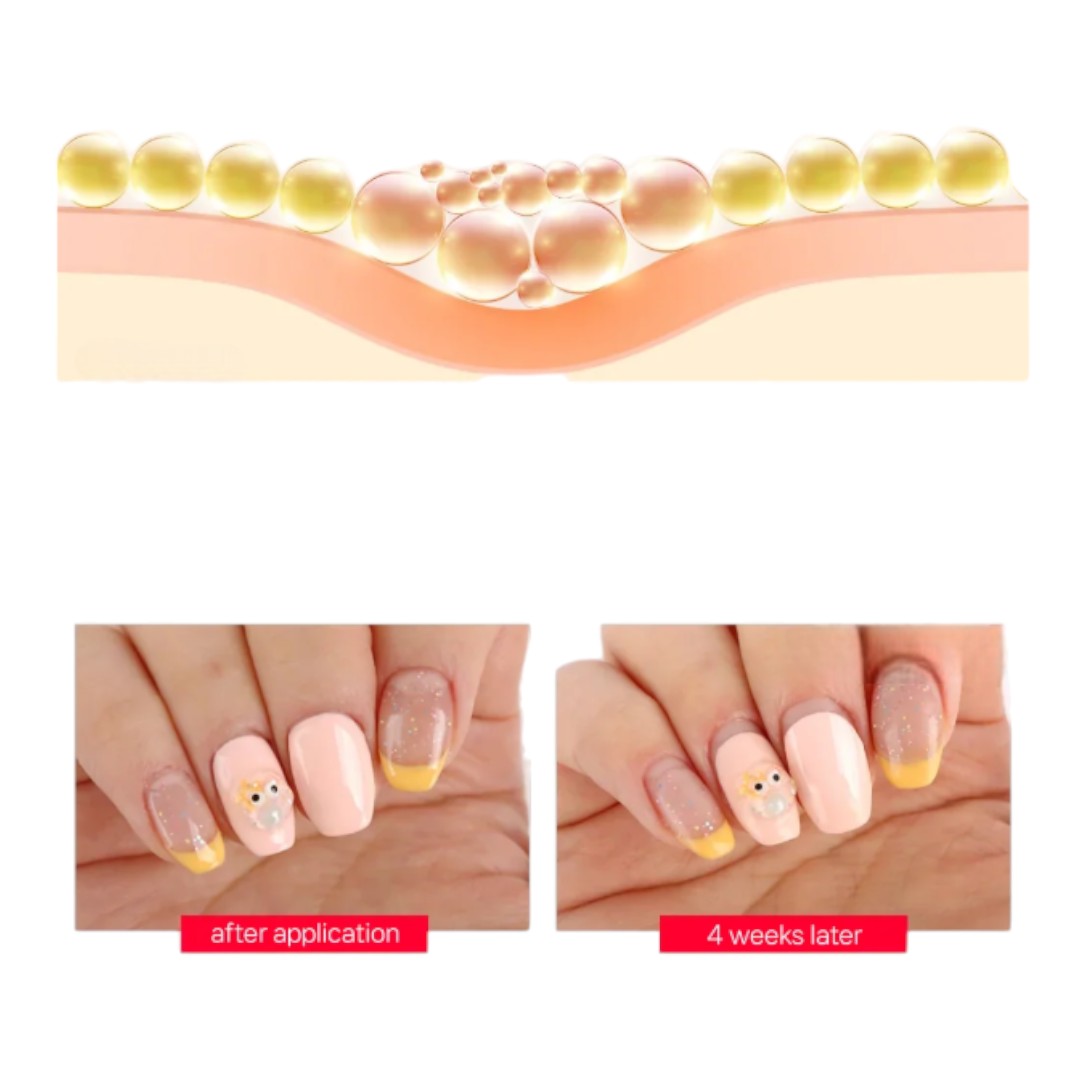 Jello Jello killing Gel Base Coat, burn gel​, burning gel​