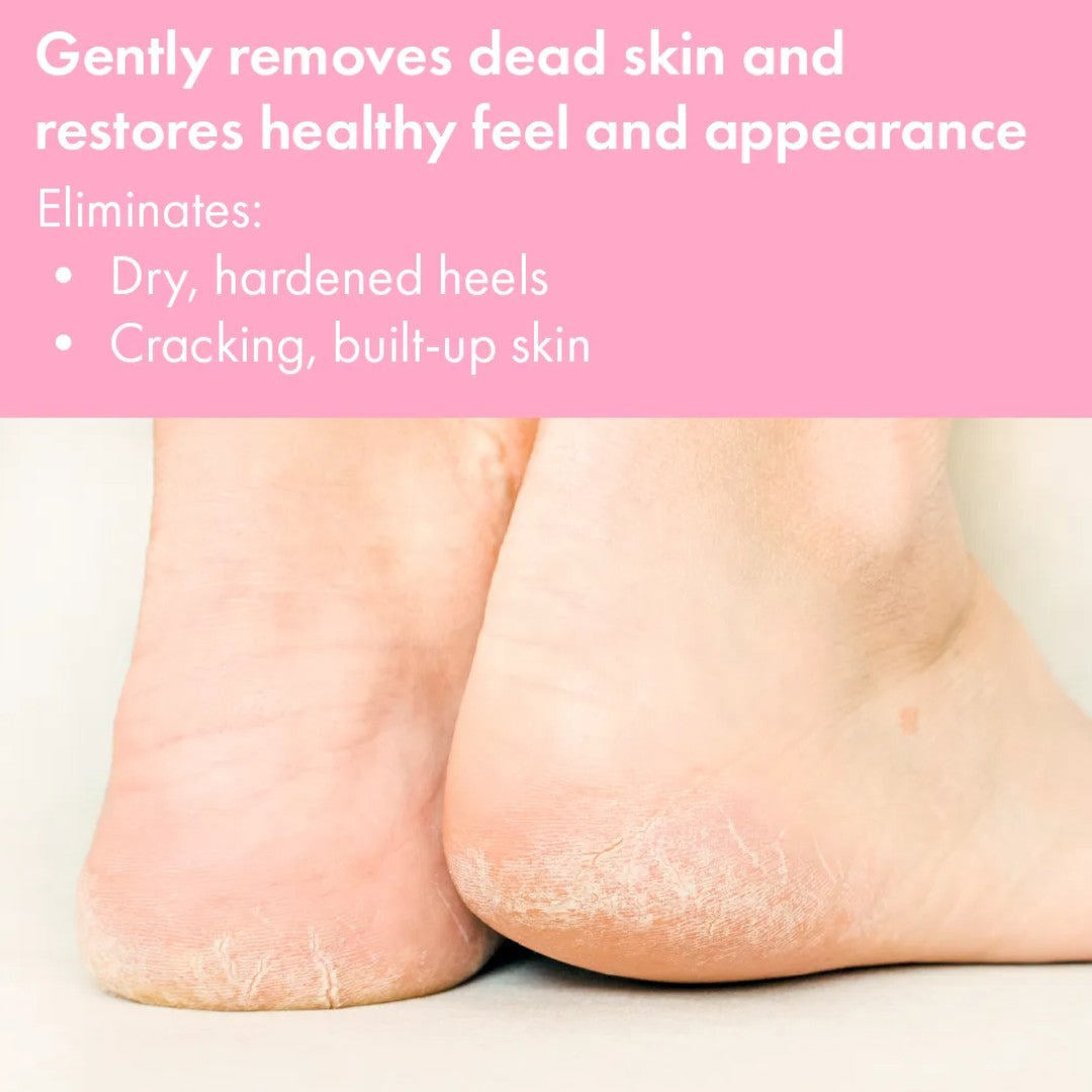 VITE20 Heels Foot Cream 4oz
