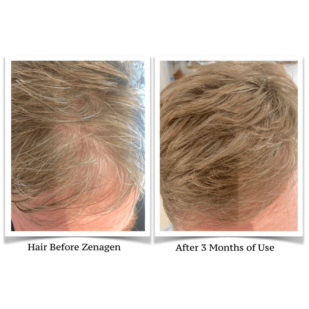 Zenagen Thickening Hair Serum 30ml, best hair growth products, zenagen​, zenagen canada​, zenagen hair​, zenagen hair products​, zenagen hair serum