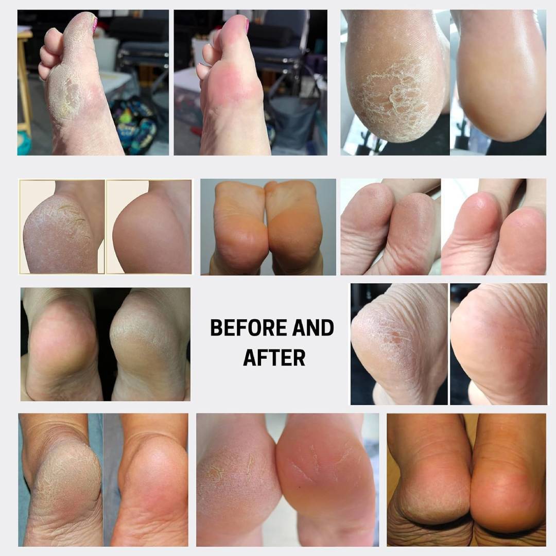 Estemio Therapy In Salon - Foot Bubble Softener 80Ml