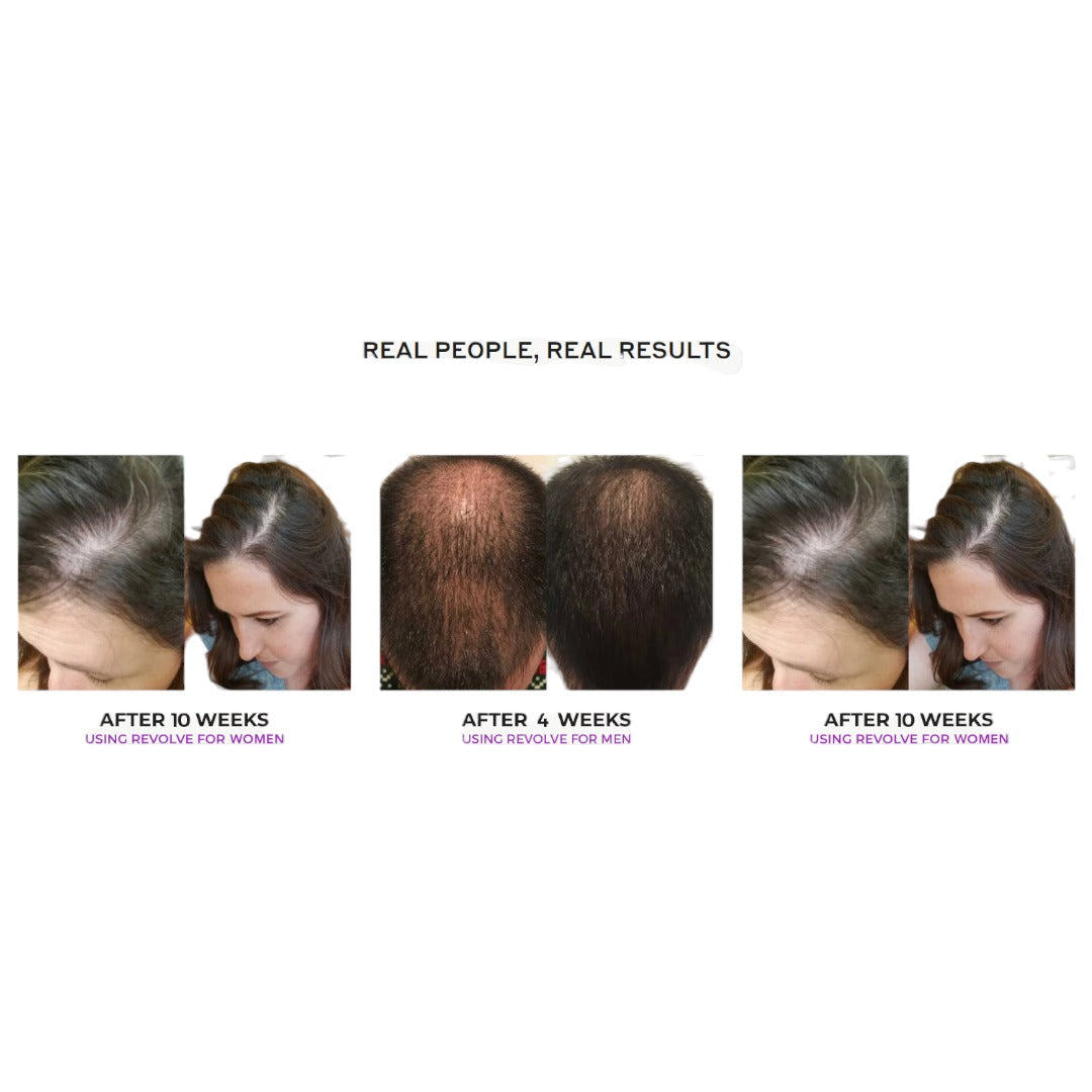 Zenagen Revolve Thickening Shampoo For Women 200ml