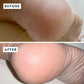 Voesh Solemate Heel Repair Balm