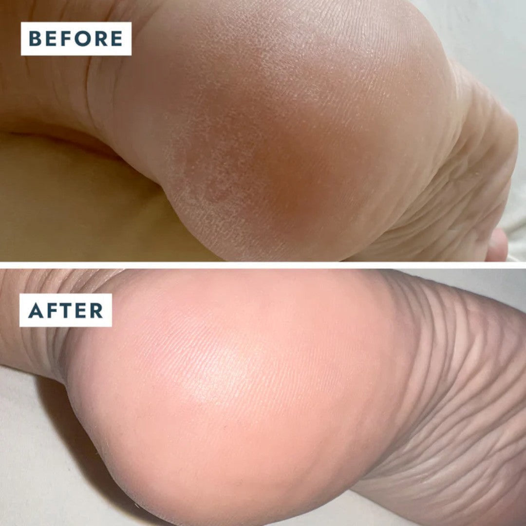 Voesh Solemate Heel Repair Balm