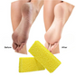 Disposable Pumice - Yellow Medium (Pack of 40)