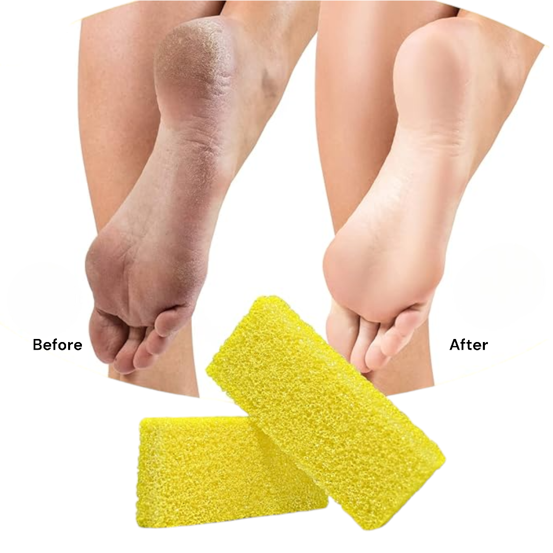 Disposable Pumice - Yellow Medium (Pack of 40)
