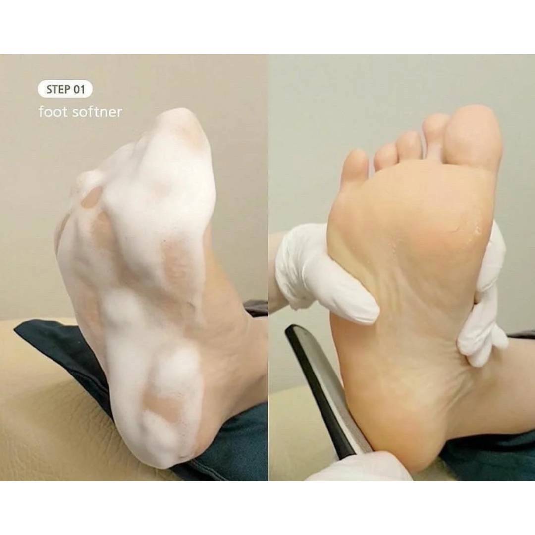 Estemio Therapy In Salon - Foot Bubble Softener 80Ml